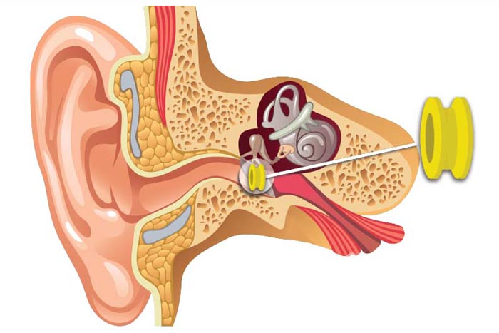 Surgeon performing tympanoplasty eardrum repair surgery at ENT clinic Jayanagar