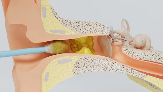 ENT doctor performing microsuction ear wax removal procedure Jayanagar Bangalore