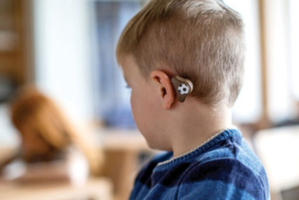 pediatric bone conduction implant surgery in BTM Layout