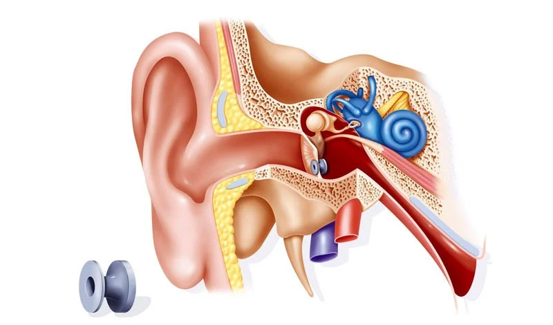 Myringotomy grommet clinic Jayanagar