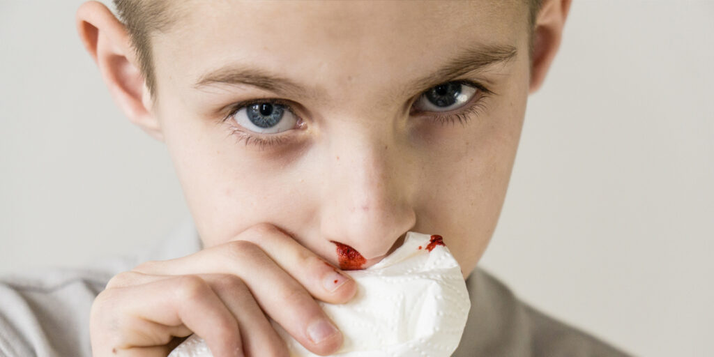 Best pediatric epistaxis clinic in Jayanagar