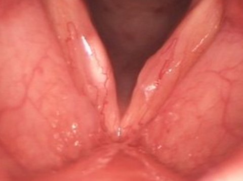Vocal cord specialist in Kanakapura Road