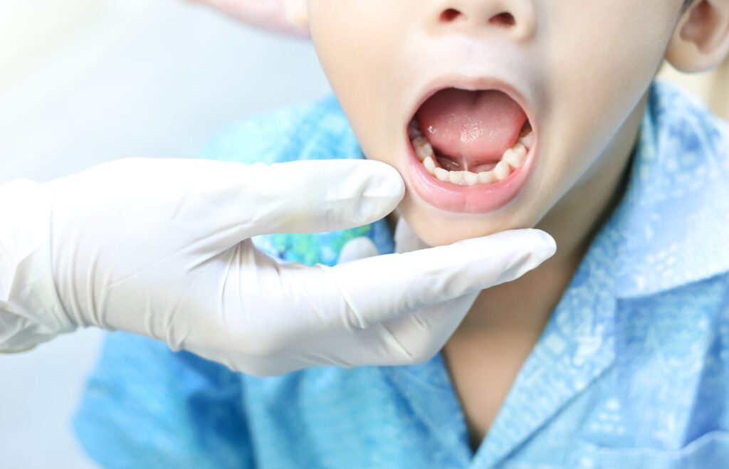 Best tongue tie clinic in Jayanagar